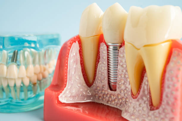 Reliable Upper Fruitland, NM Dental Services Solutions